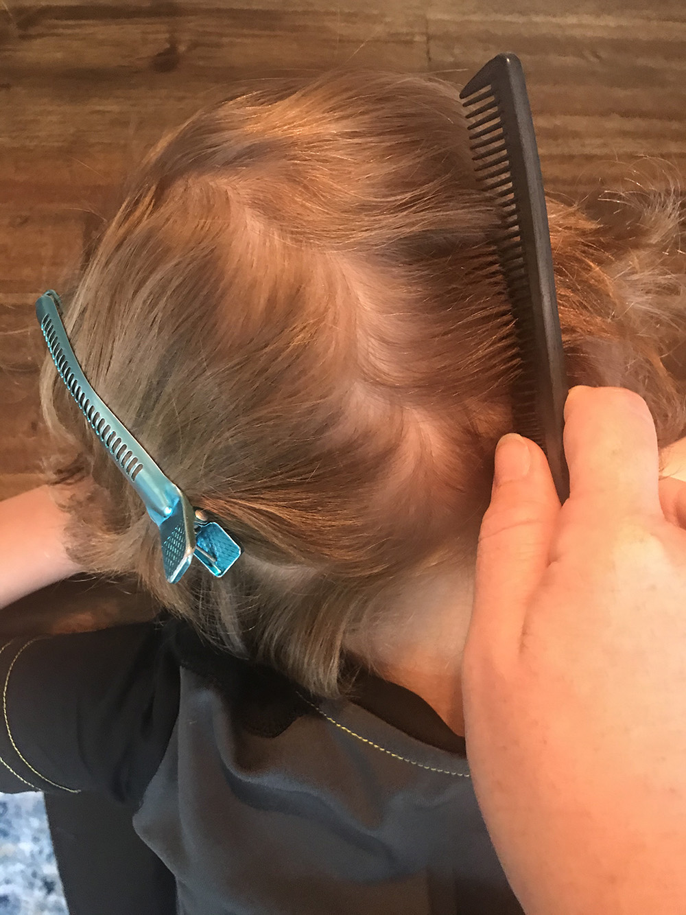 Lice Removal & Lice Treatment in Columbus, Ohio LiceDoctors